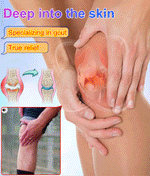 Load image into Gallery viewer, Gout Treatment Cream
